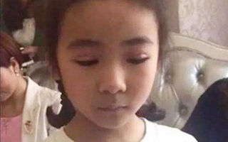 Không hài lòng với đôi mắt một mí của con gái, người mẹ đã làm một việc khiến ai nấy sốc nặng
