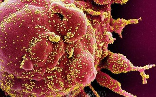 SARS-CoV-2 gây viêm mạch máu, ngăn chặn khả năng miễn dịch