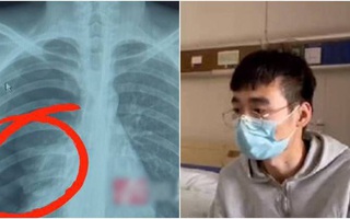 Cố hát karaoke với giọng quá cao trong sinh nhật bạn, thanh niên 25 tuổi bị "vỡ phổi" suýt mất mạng