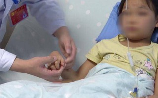IQ của cô bé 11 tuổi chỉ như trẻ 3 tuổi, nguyên nhân bắt nguồn từ con mèo: Bác sĩ cảnh báo gia đình có trẻ nhỏ nên cẩn thận khi nuôi thú cưng