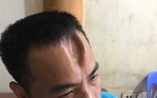 Dùng cào sắt đánh lún sọ, dập não hàng xóm đang phơi thóc
