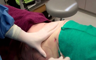 Vụ người phụ nữ tử vong sau khi hút mỡ bụng ở TP.HCM: Nạn nhân là nhân viên spa, công an vào cuộc điều tra
