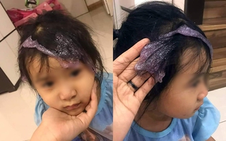 Bé gái nghịch dại khiến ''chất nhầy ma quái'' ôm trọn mái tóc, mẹ trẻ vội vàng lên mạng cầu cứu cách loại bỏ và nhận về 1 rổ kinh nghiệm
