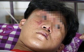 Công an điều tra vụ côn đồ vào tận trường bắt, đánh nhiều học sinh