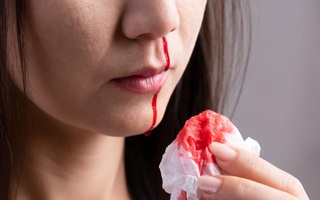 5 vị trí cơ thể này nếu bất ngờ chảy máu thì coi chừng bạn đã mắc ung thư từ lâu mà không biết