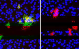 Virus SARS-CoV-2 đột biến đang "lén lút" qua mắt hệ miễn dịch bằng cách nào?