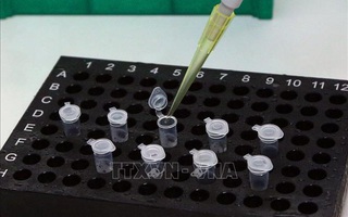 Các trường hợp F1 của bệnh nhân 2002 âm tính lần 1 với SARS-CoV-2