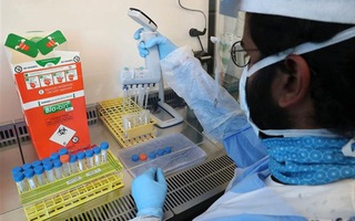 Nghiên cứu: Biến thể của virus SARS-CoV-2 phát hiện ở Anh gây tử vong cao hơn
