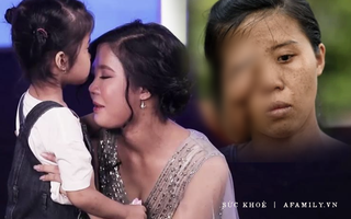 Mẹ đơn thân "một mắt" và 3 cuộc đại phẫu thay đổi cuộc đời, phản ứng khi con gái gặp lại mẹ tuy bẽ bàng nhưng ai cũng phải rớt nước mắt