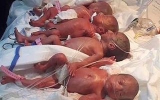 Góc trầm trồ: Sản phụ 25 tuổi sinh "sòn sòn" một lúc 9 đứa con khiến cả ê-kíp đỡ đẻ kinh ngạc tột độ