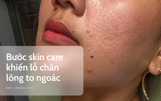 Nếu bạn cứ làm 4 bước skin care này thì lỗ chân lông trên da sẽ ngày càng to ngoác
