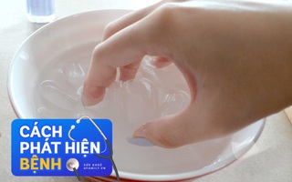 Hãy làm ngay 6 cách tự kiểm tra sức khỏe tổng thể tại nhà: Chỉ mất vài phút mà cứu tương lai khỏi bệnh tật