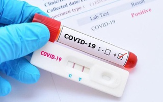 16 loại kit test nhanh kháng nguyên SARS-CoV-2 được Bộ Y tế cấp phép