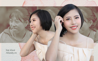 26 năm bị miệt thị và gán cho biệt danh Thị Nở, cô gái nhờ PTTM mà "lột xác" đến chính mẹ đẻ cũng ngỡ ngàng không nhận ra