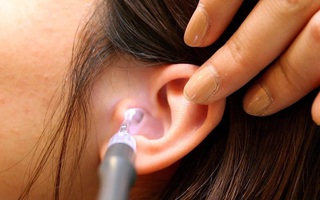 Học theo TikToker loại bỏ ráy tai bằng oxy già liệu có an toàn? Đây là câu trả lời của chuyên gia