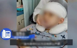 Trung Quốc: Tin tưởng gửi con trai 9 tuổi đến trường, cha mẹ chết điếng nhìn con bị đánh tàn bạo đến mức nứt nộp sọ, chảy máu não