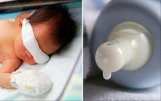 Bé sơ sinh nhập viện sau 4 ngày được mẹ nhỏ sữa vào mắt