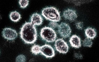 Deltacron - Có phải là biến thể mới lai giữa chủng Delta và Omicron?