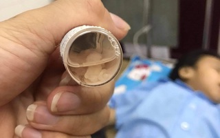 Những điểm bất thường vụ bé gái 3 tuổi bị người tình của mẹ đóng 9 chiếc đinh vào đầu qua lời kể của người đầu tiên báo công an