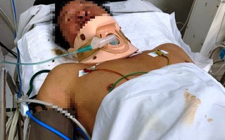 Bị tôn trên xe ba gác cắt trúng cổ, người đàn ông suýt chết