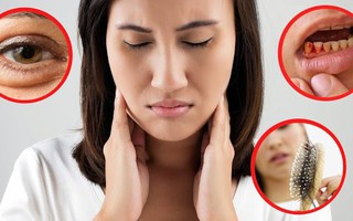 Cơ thể bị "cạn kiệt" vitamin sẽ phát ra 6 dấu hiệu, chủ quan bỏ qua có thể tổn thọ 