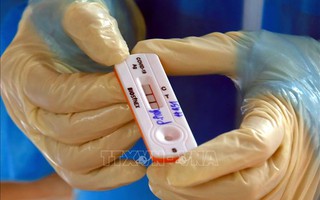 Những ai có nguy cơ cao bị tái nhiễm SARS-CoV-2?