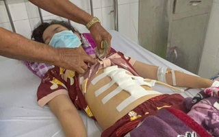 Tin thêm vụ cha dượng đánh con riêng của vợ bị dập lách, gãy xương sườn