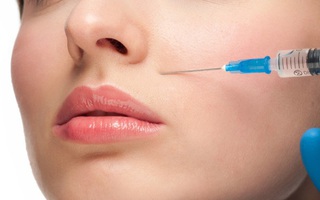 Cảnh báo: Mất thị lực sau tiêm filler làm đầy rãnh má tại tiệm tóc