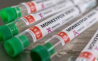 Bệnh đậu mùa khỉ: Bỉ ban hành lệnh cách ly, Mỹ hỏa tốc mua vắc-xin