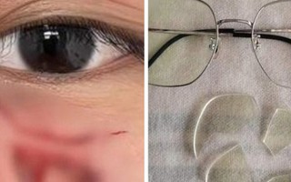 Đấm học sinh khâu 16 mũi, thầy giáo ở Trung Quốc bị sa thải