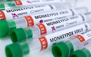 WHO phát hiện virus gây bệnh đậu mùa khỉ trong tinh dịch của bệnh nhân