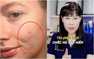 Bác sĩ cảnh báo: Thủ phạm gây nên mụn trứng cá, nguy hiểm cận kề mà chị em chẳng mấy bận tâm