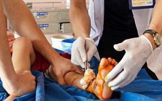Tai nạn cửa tự động ở trẻ em và những lưu ý an toàn để cha mẹ phòng tránh