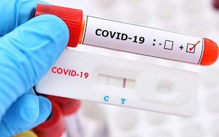 Ngày 25/7: Ca COVID-19 mới tăng lên gần 900; có 29 F0 nặng phải thở oxy