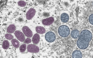 Nhật Bản phê duyệt vaccine phòng bệnh đậu mùa khỉ