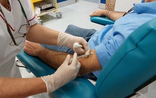 Thế giới gần 32.000 ca đậu mùa khỉ, cảnh báo virus ở da gấp 1.000 lần cổ họng