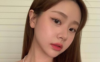 Ăn uống thế nào để ngừa mụn hiệu quả?