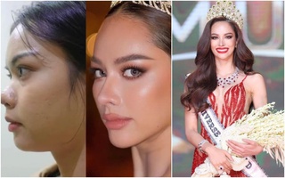 Tân Hoa hậu Hoàn vũ Thái Lan 2022 lộ ảnh trước khi phẫu thuật thẩm mỹ