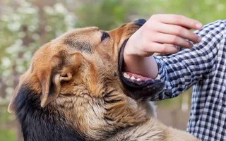 Quảng Bình: Tử vong vì bệnh dại sau 3 tháng bị chó cắn