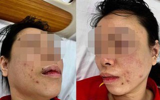 Người phụ nữ tố bị chồng cũ 'bắt cóc' tra tấn dã man: Nhốt trong ô tô, đánh từ Hà Nội lên Hòa Bình