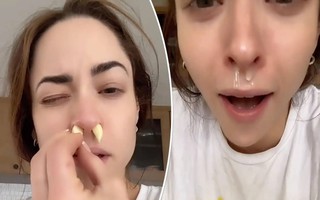 Nhét tỏi vào mũi để làm sạch xoang, chữa cảm cúm, chuyên gia nói 'càng tồi tệ hơn'