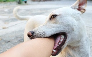 Theo bố đến chỗ làm, bé gái ở Hà Nội bị 4 con chó tấn công