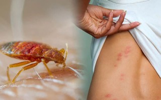 Cách phòng chống và diệt loài rệp giường 