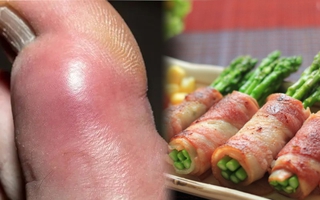 3 loại rau, 4 loại nước là "thủ phạm" gây bệnh gút: Đáng tiếc là nhiều người trong chúng ta đang làm sai