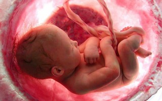 Dây rốn quấn 2 vòng quanh cổ thai nhi, 1 thói quen khi mang thai của người mẹ là "thủ phạm"