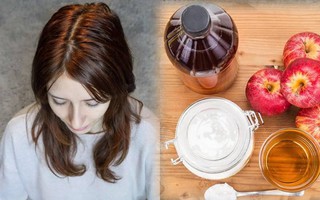 Mạng xã hội "dậy sóng" với trào lưu No poo chỉ dùng baking soda, giấm táo gội đầu, chuyên gia "vạch trần sự thật"