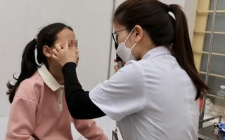 Nghệ An: Tự chế pháo bằng diêm, bé gái 11 tuổi bị bỏng hai mắt