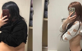 Cô gái Hàn Quốc giảm 75kg chia sẻ tác hại từ giảm cân tiêu cực
