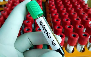 Virus Marburg khiến 9 người tử vong ở châu Phi có khả năng lây sang Việt Nam không?