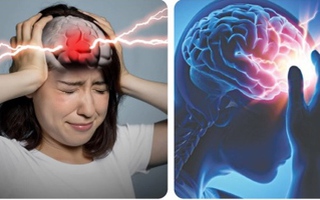 4 dấu hiệu cảnh báo cơn đột quỵ trước 1 tuần, 30 ngày đến vài tháng